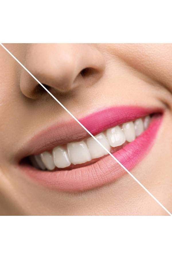 Inuwet Çiçek Detaylı Dudak Nemlendiricisi-Çilek Kokulu